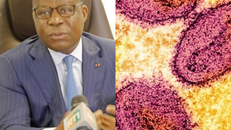 Variole du Singe : La Côte d’Ivoire Renforce la Riposte Face à l’Urgence Sanitaire